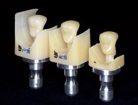 歯科用デジタル材料の画像